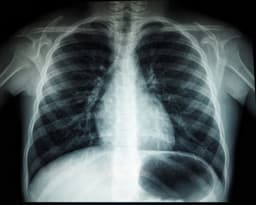 Hidden Disease: Tuberculosis Persists in Peru’s Shadows